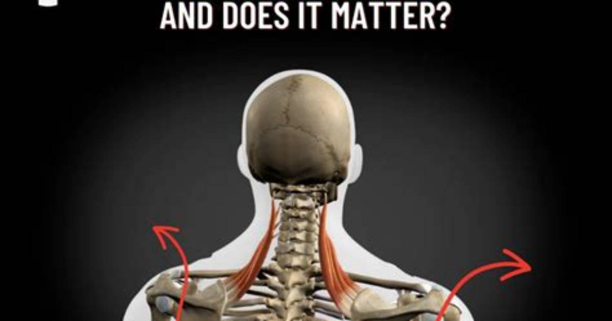 What Can Cause Winged Scapula?