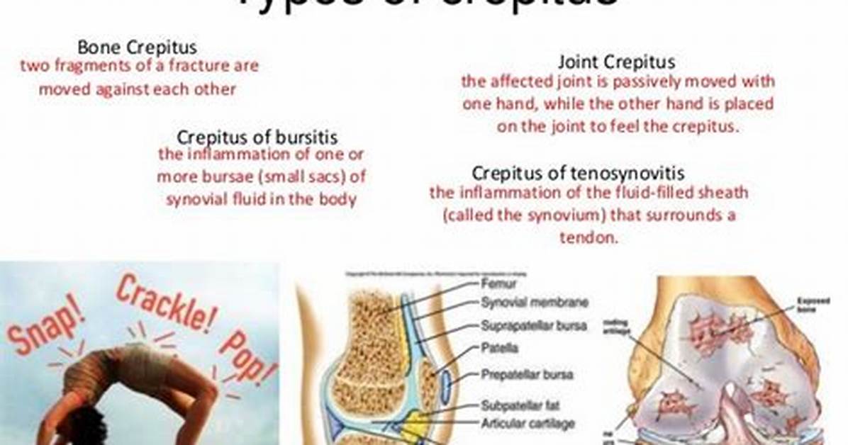 What Can Crepitus Indicate