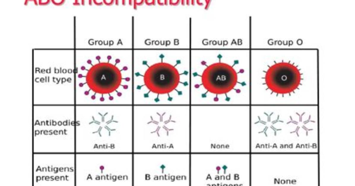 What Causes Abo Incompatibility? | Contextresponse. Com