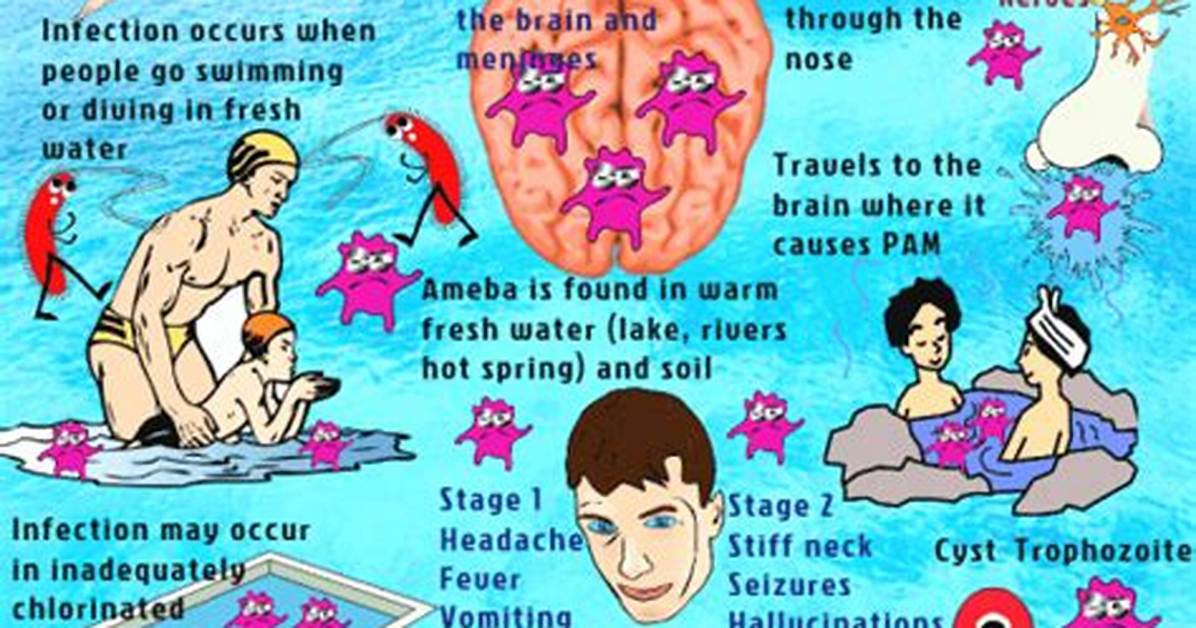 What Causes Amebic Meningitis?