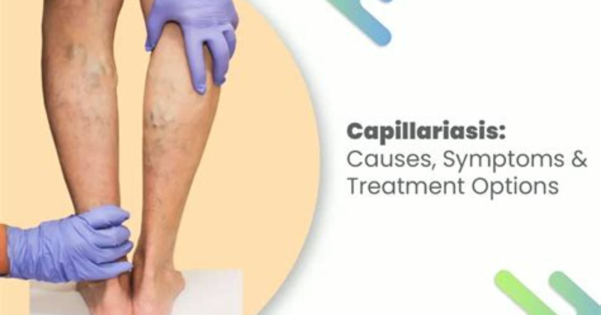 What Causes Capillariasis?