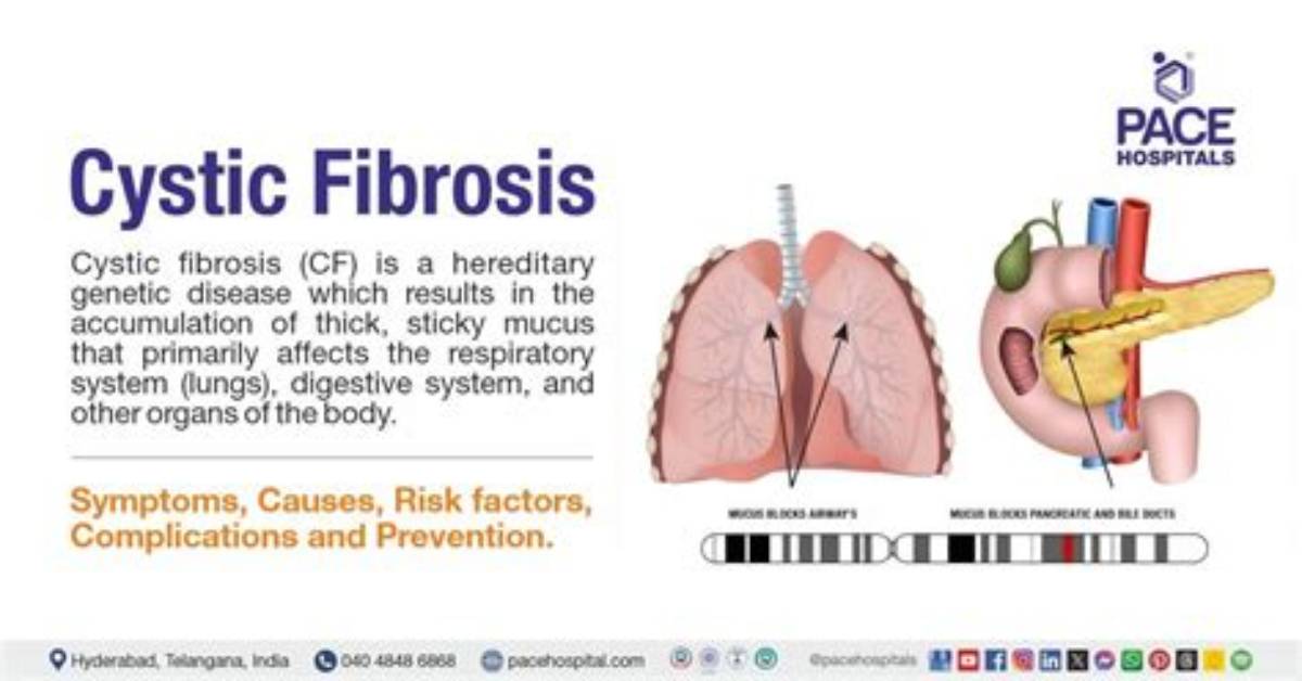 What Causes Cf Disease