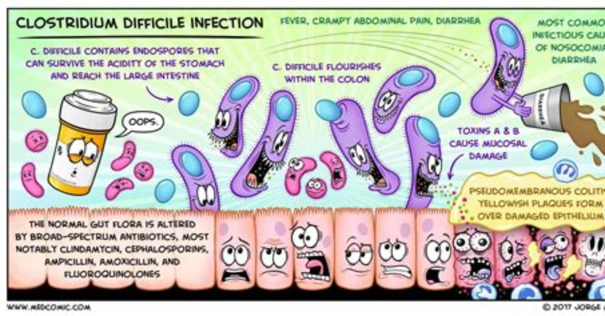 What Causes Clostridium Difficile
