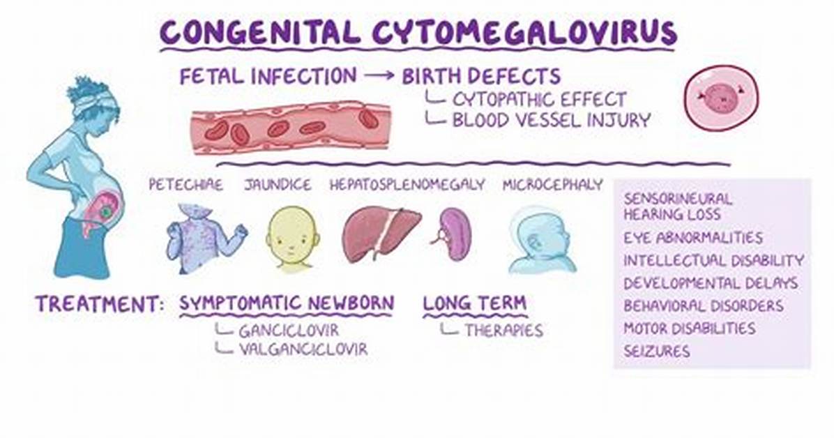 What Causes Cmv