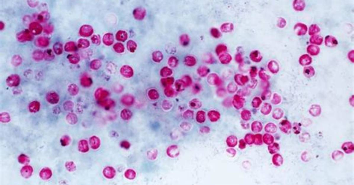 What Causes Cryptosporidium