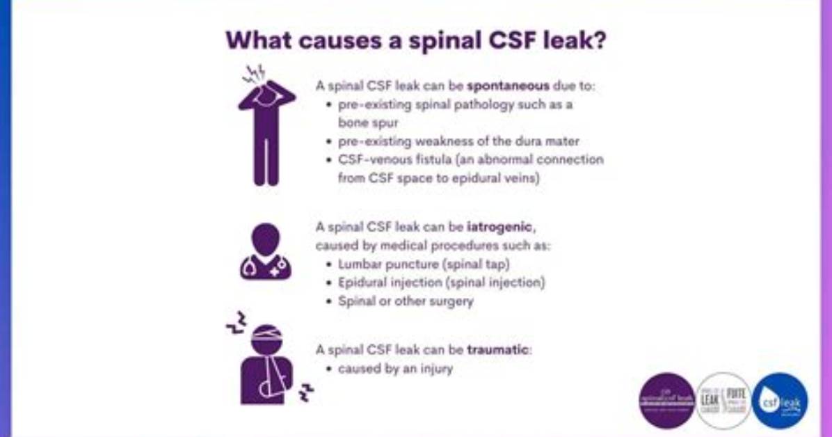 What Causes Csp