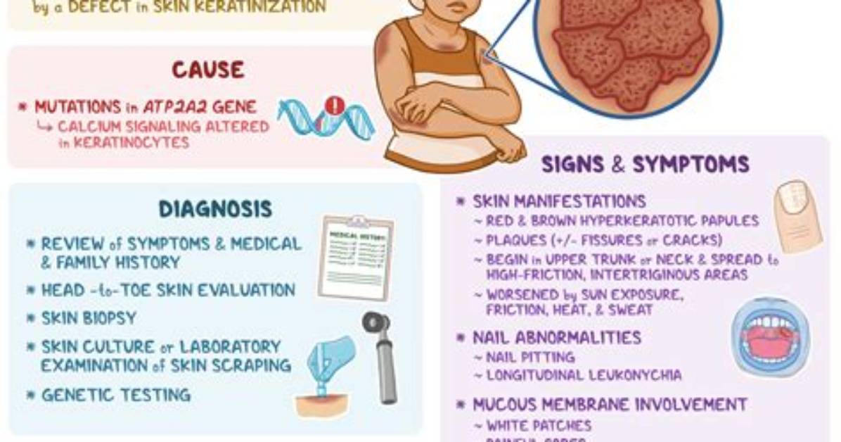 What Causes Dariers Disease