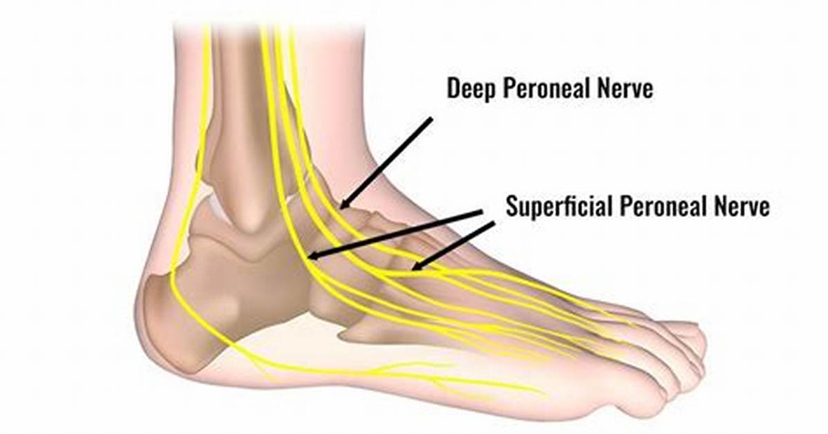 What Causes Deep Peroneal Nerve Damage