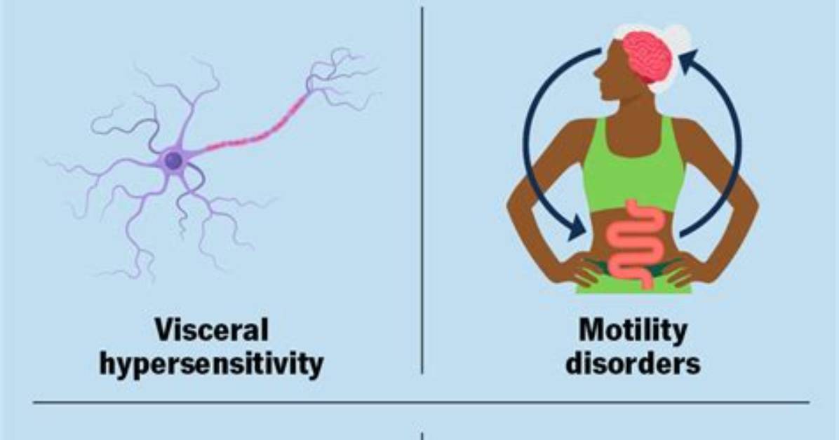 What Causes Dyspepsia