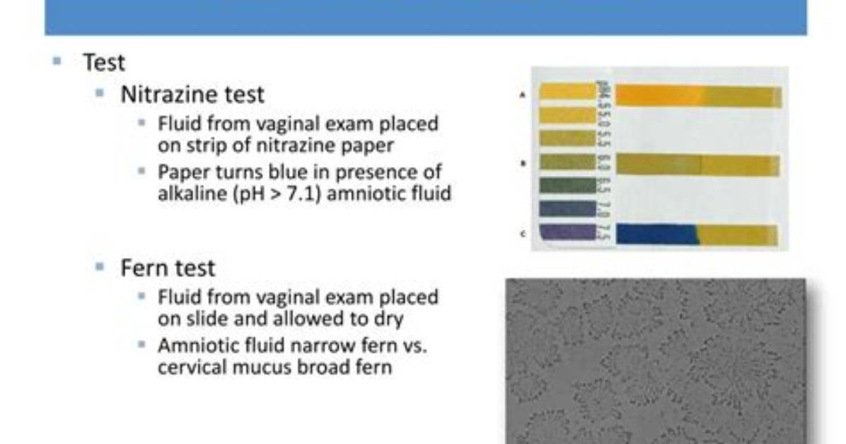 What Causes False Positive Nitrazine Test