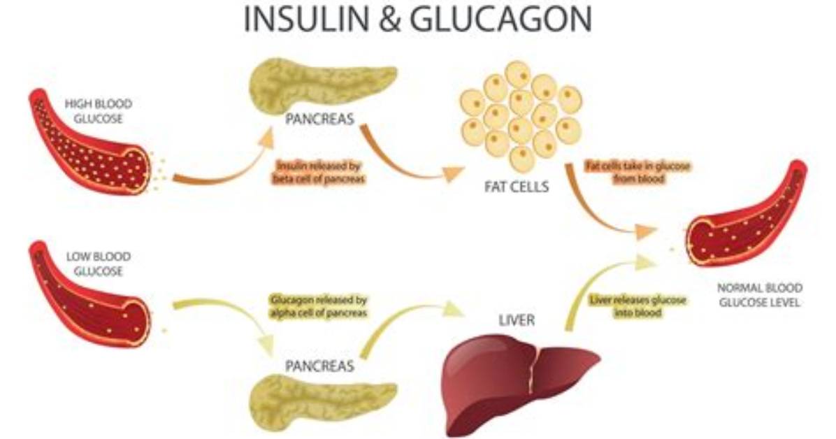 What Causes High Glucagon