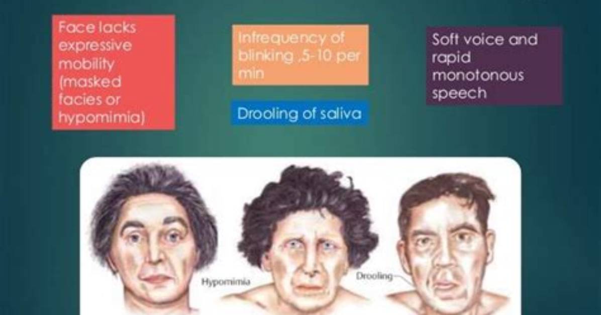 What Causes Hypophonia