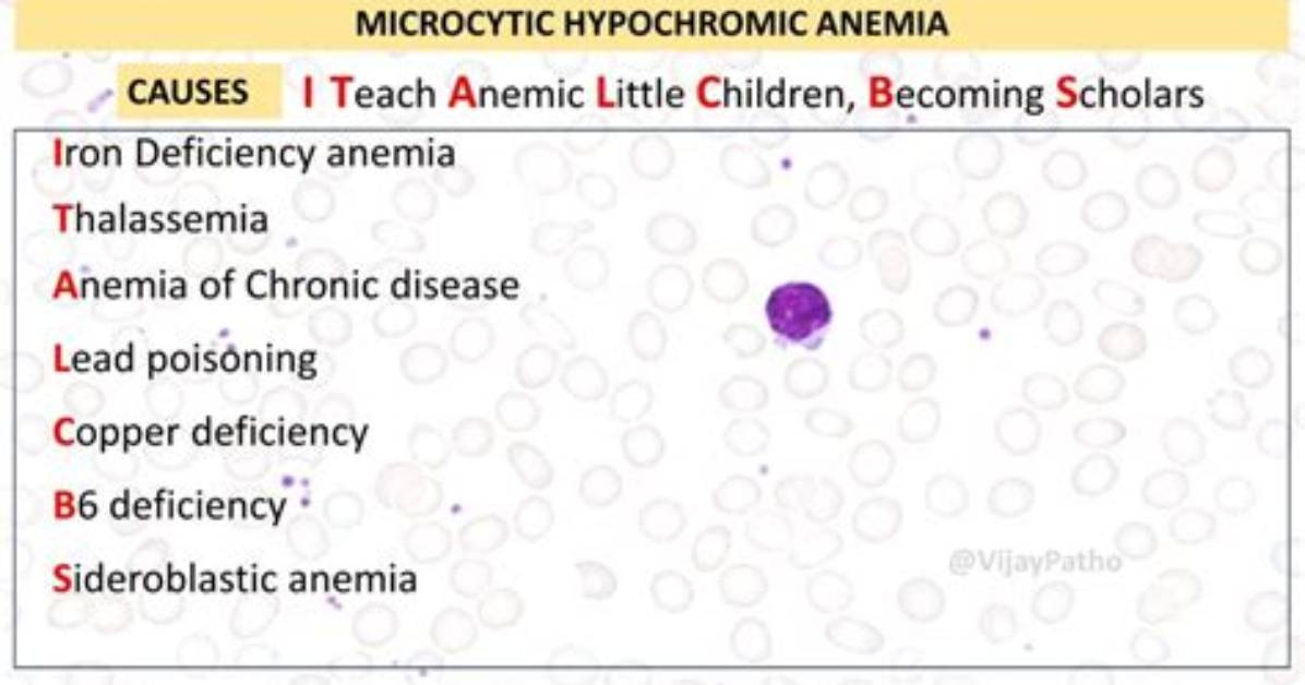 What Causes Microcytic Hypochromic Anemia?