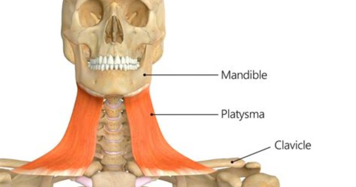 What Causes Paralysis of the Platysma