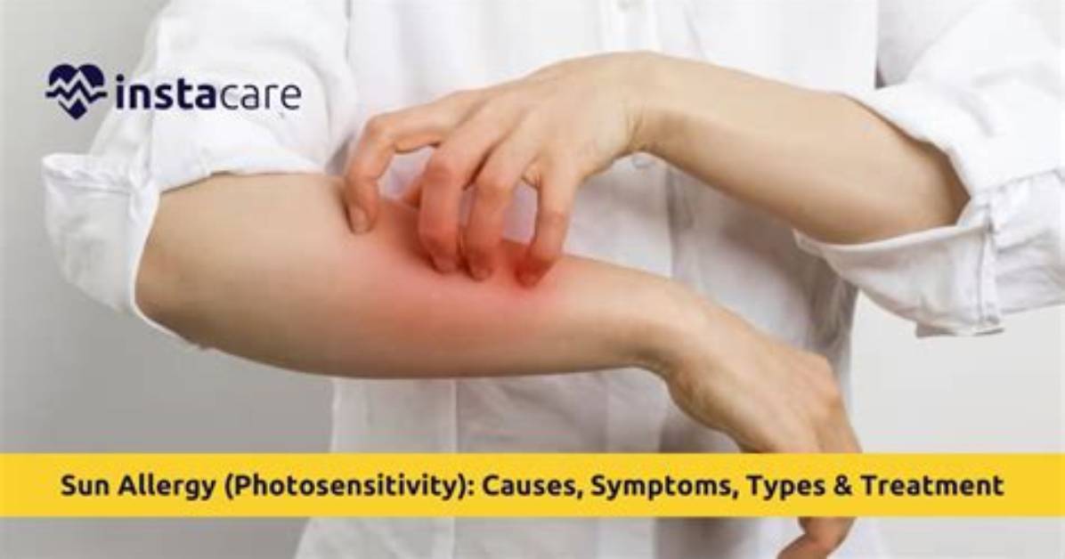 What Causes Photosensitivity? | Contextresponse. Com