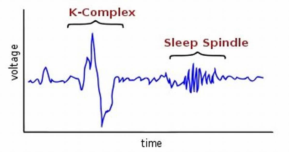 What Causes Sleep Spindles