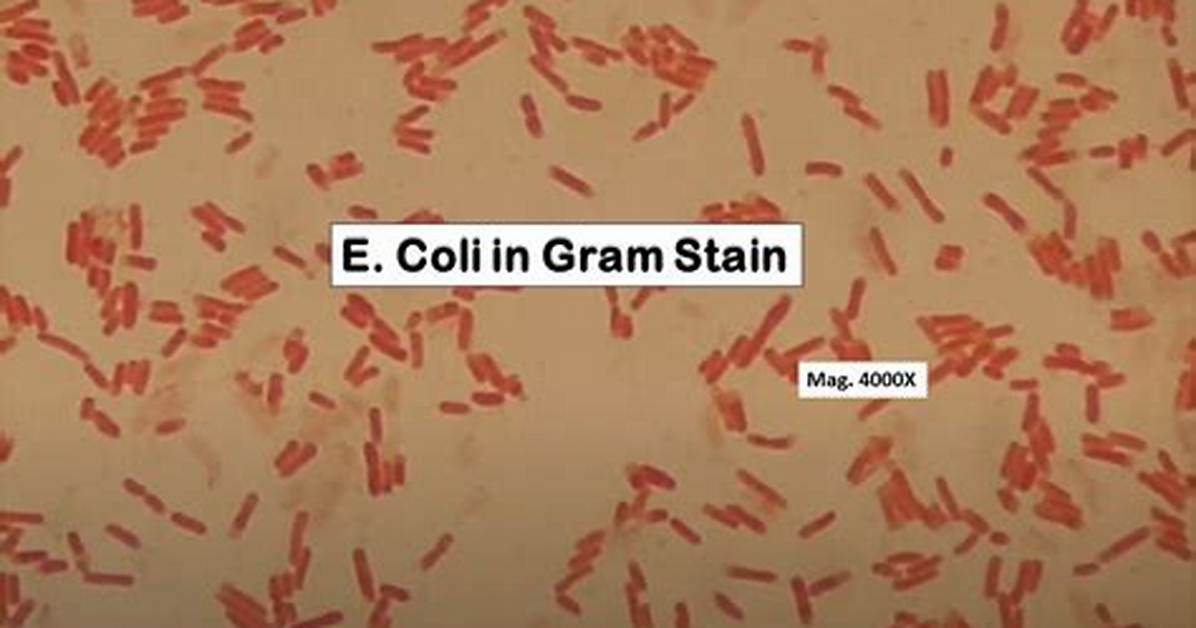 What Color Does E Coli Stain?