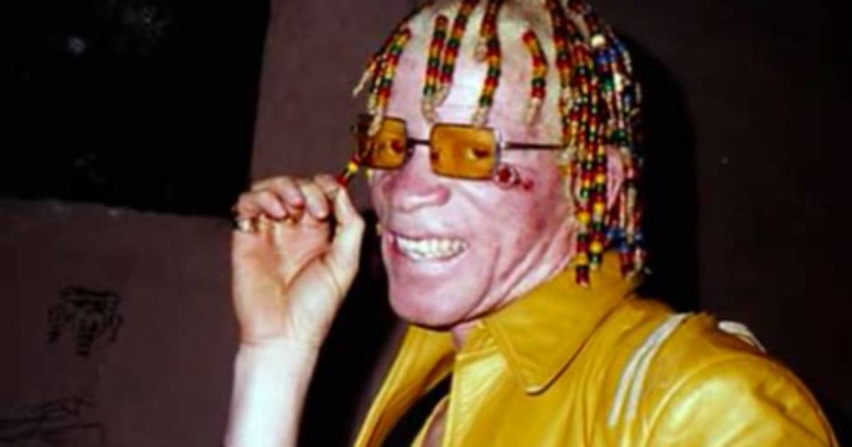 What Disease Does Yellowman Have?