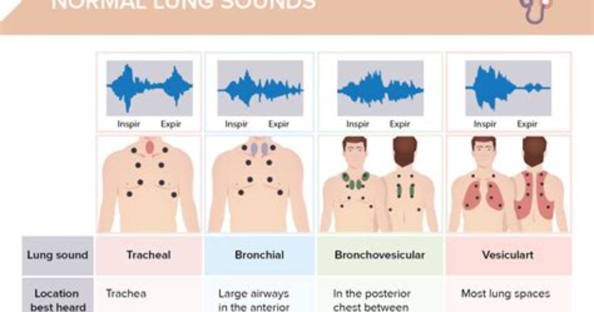 What Do Absent Lung Sounds Indicate