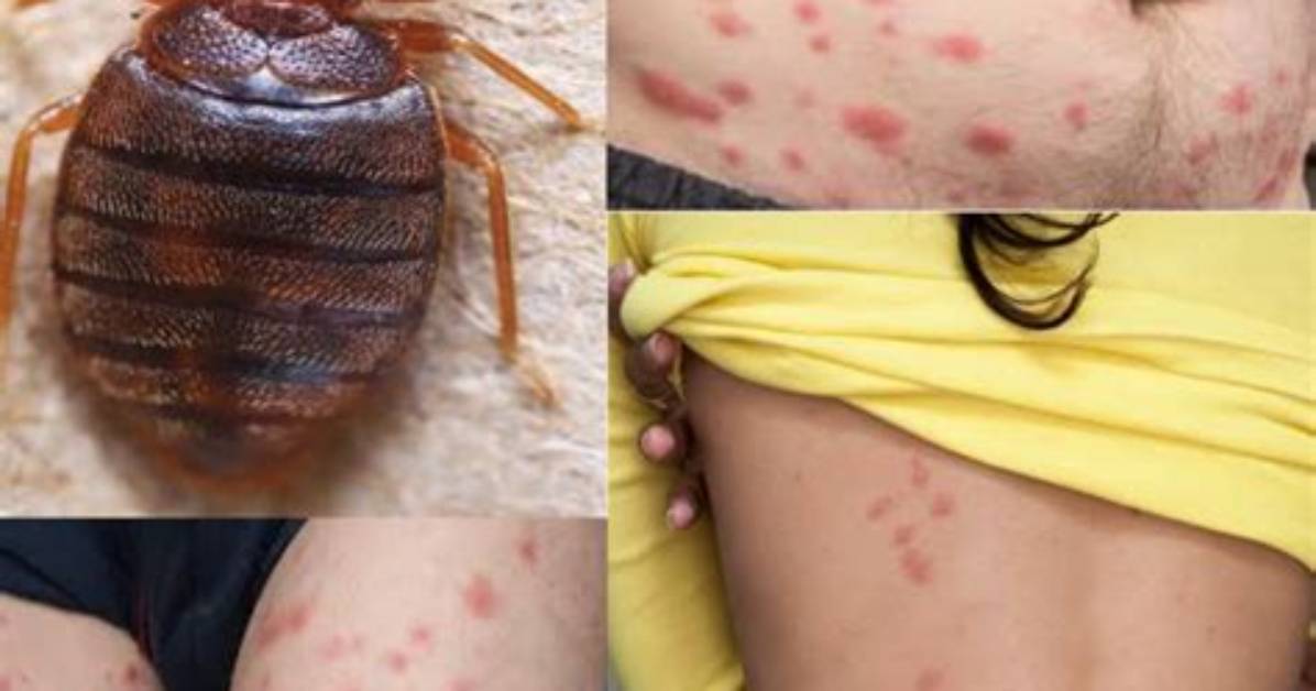 What Do Bed Bugs Feed on Other Than Blood