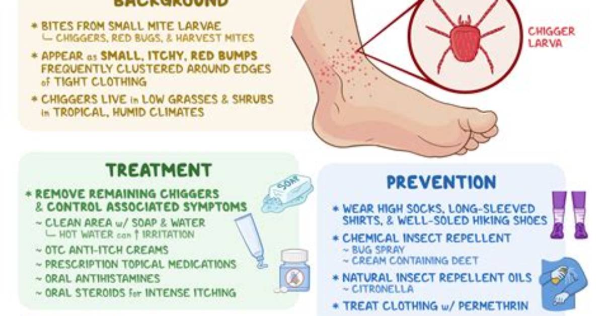 What Do Chigger Bites Look Like?