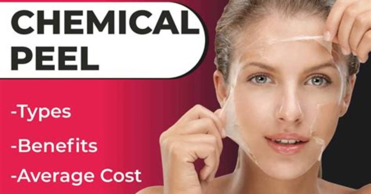 What Do Exfoliating Peels Do