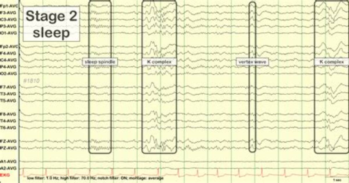 What Do K Complexes Do