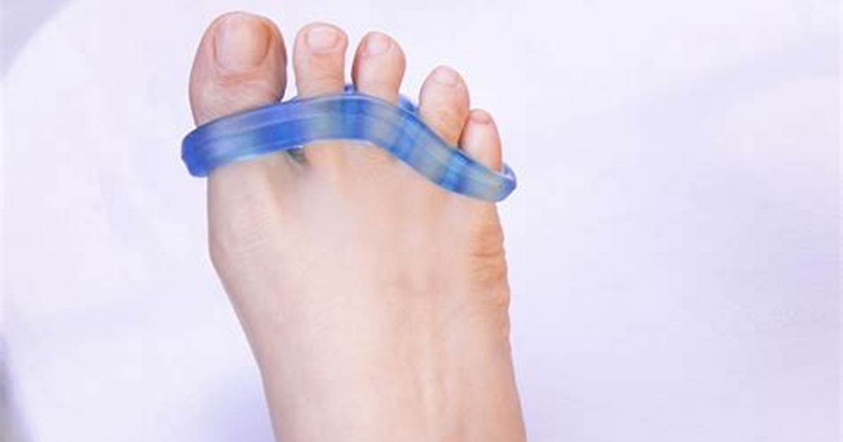 What Do Toe Separators Do