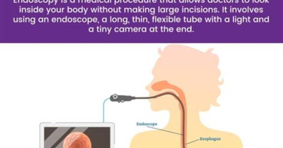 What Doctors Do Endoscopies?