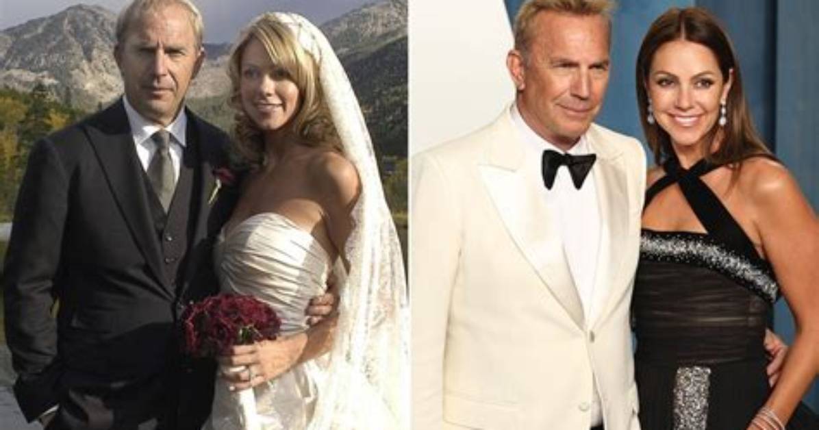 What Does a Baumgartner Restoration Cost? – Celebrity