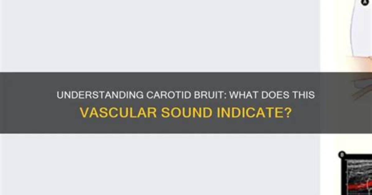 What Does a Bruit Indicate