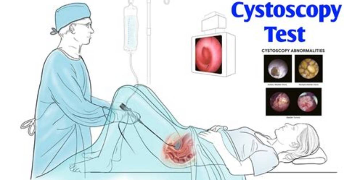 What Does a Cystoscopy Detect?