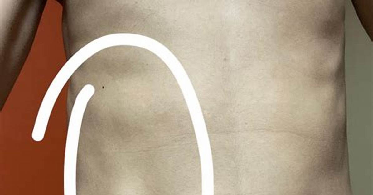What Does a Hernia Look Like on a Woman?