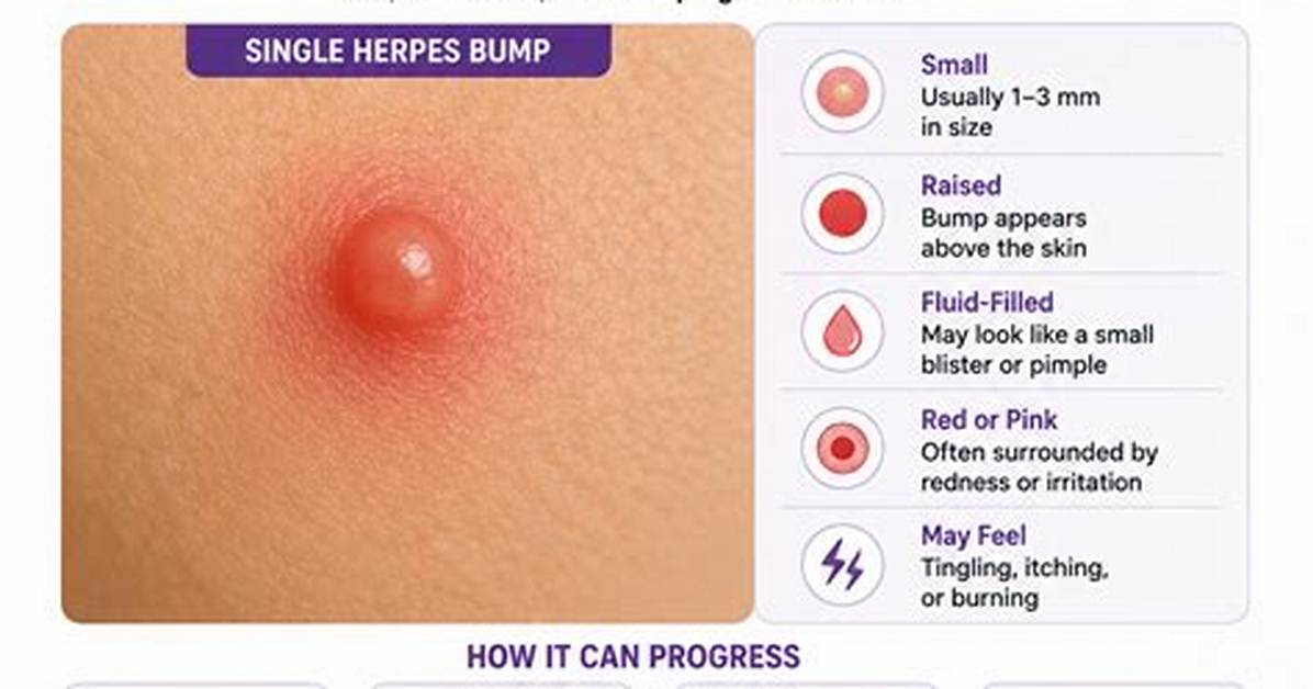 What Does a Lie Bump Look Like