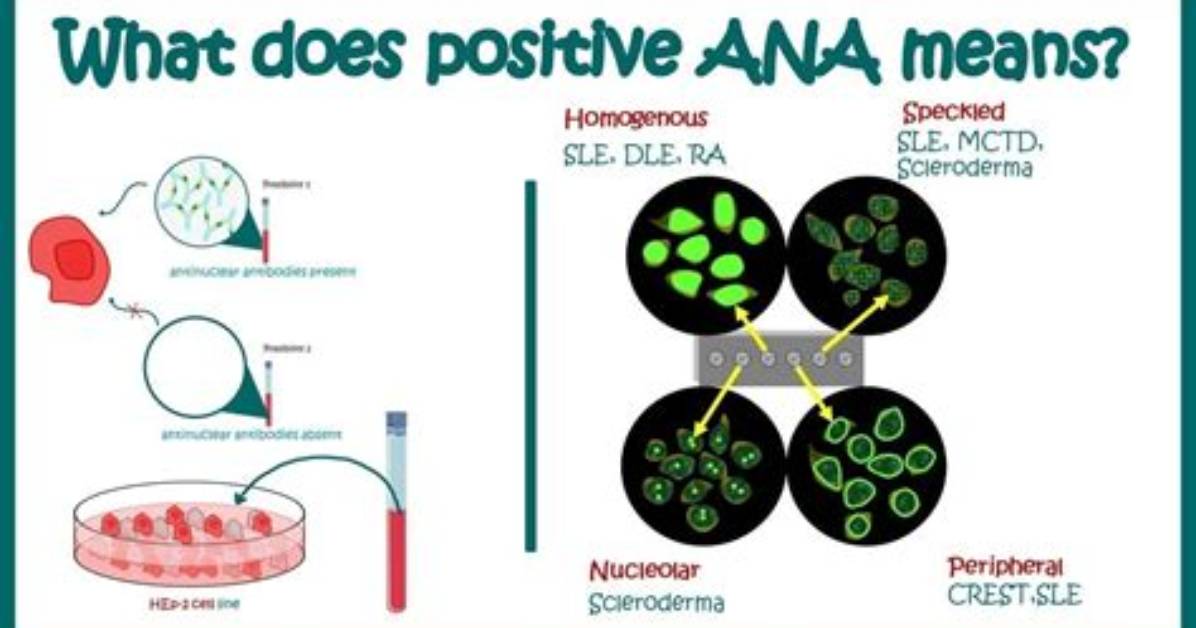 What Does a Positive Ana Indicate