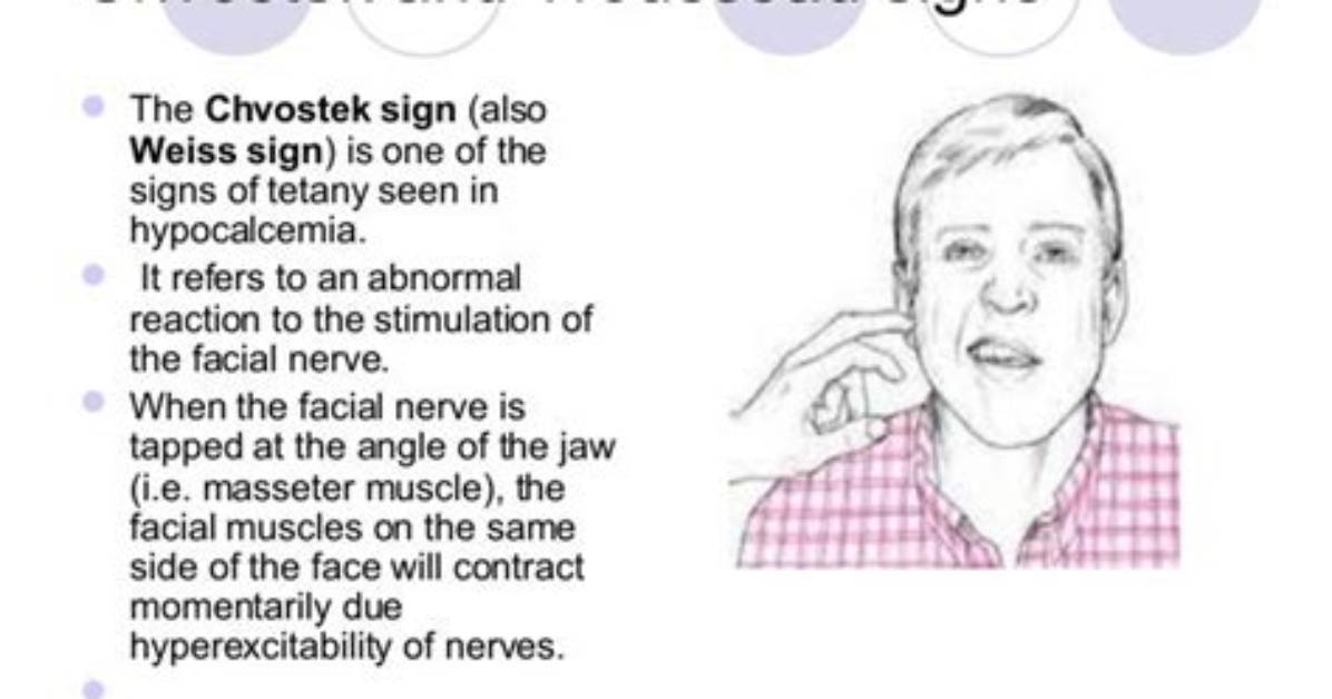 What Does a Positive Chvosteks Sign Indicate