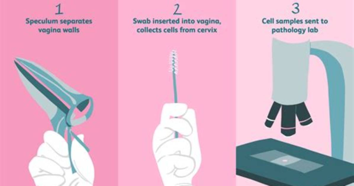 What Does a Smear Test Feel Like?
