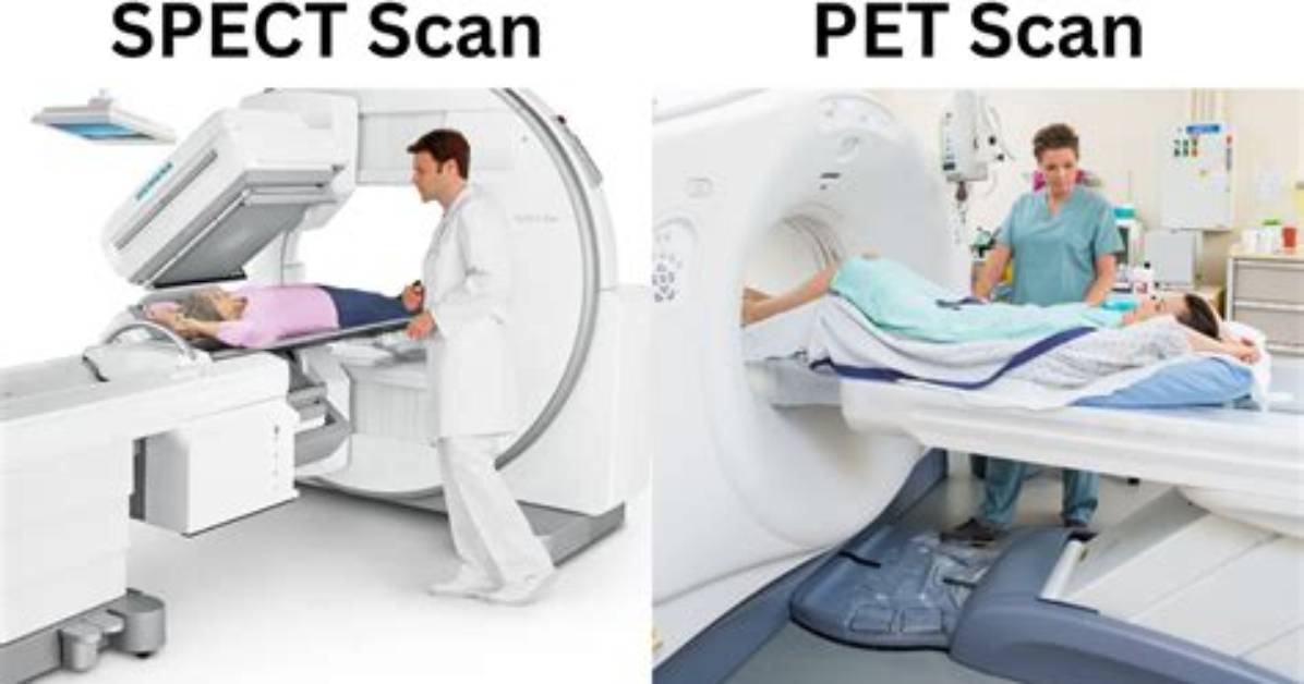 What Does a Spect Ct Scan Show