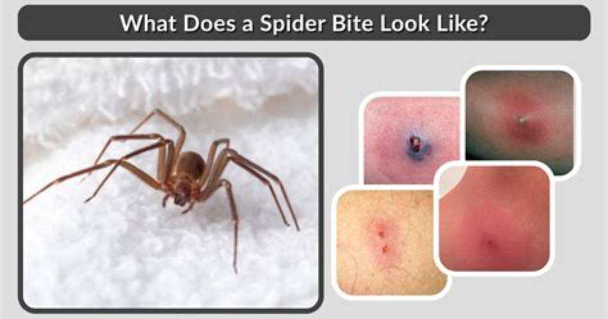 What Does a Spider Look Like