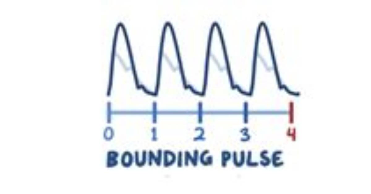 What Does a Thready Pulse Feel Like?