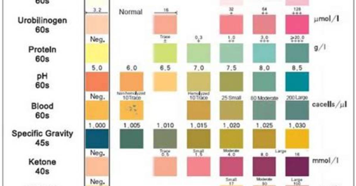What Does a Urine Dip Test for?