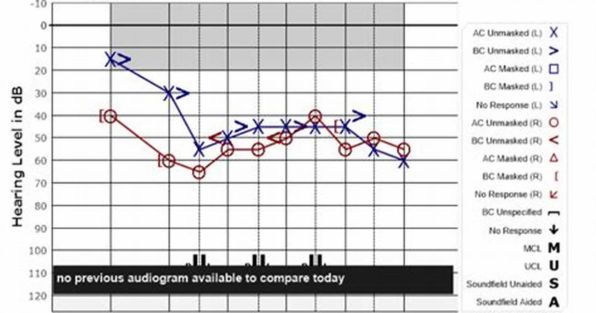 What Does an Audiogram Indicate?