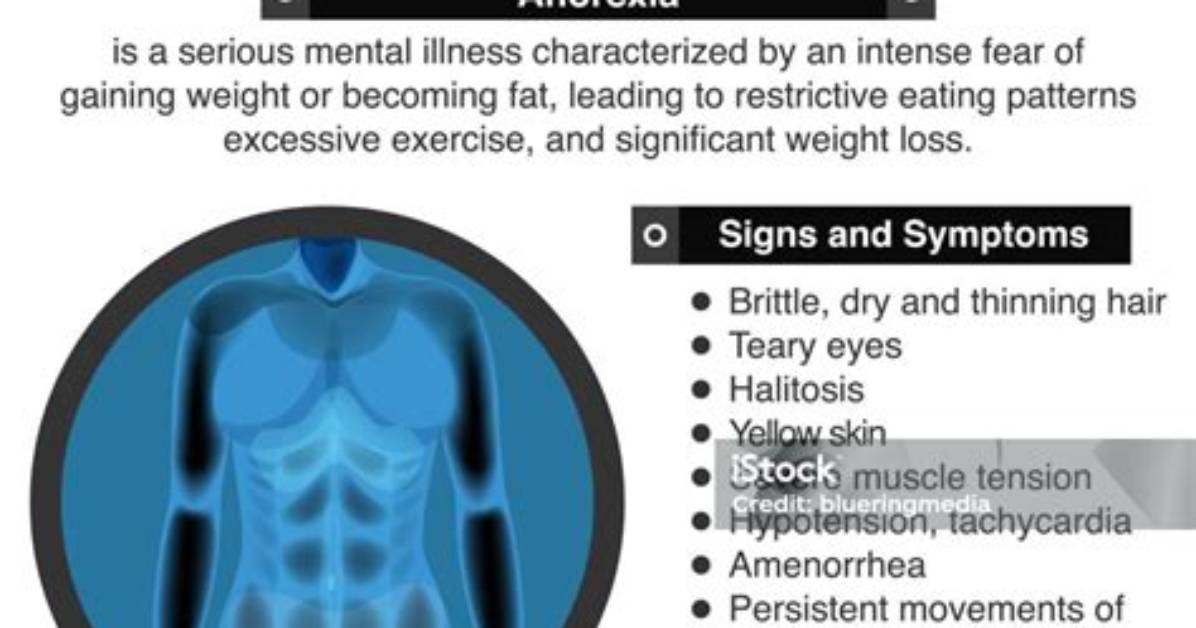 What Does Anorectic Mean?
