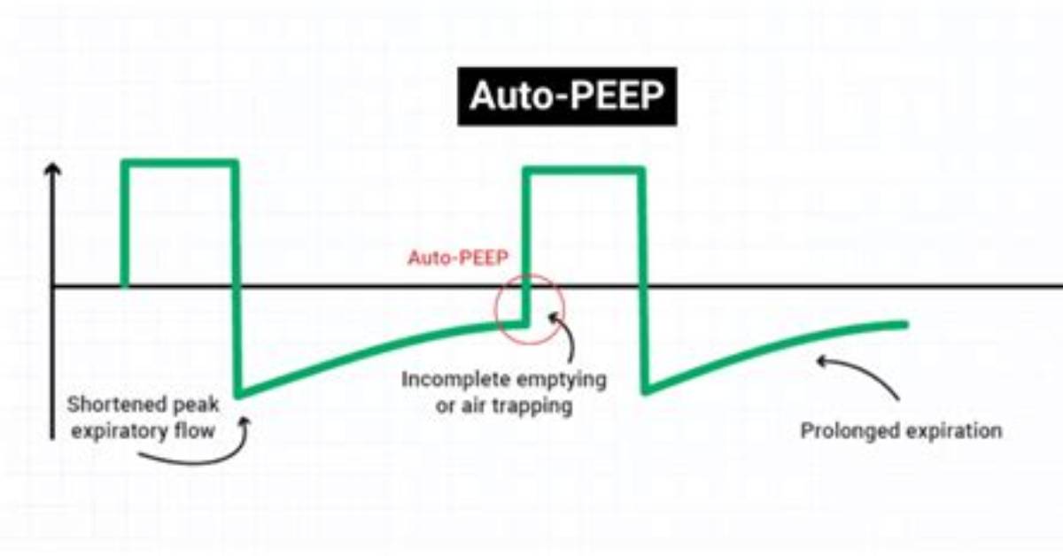 What Does Auto Peep Mean