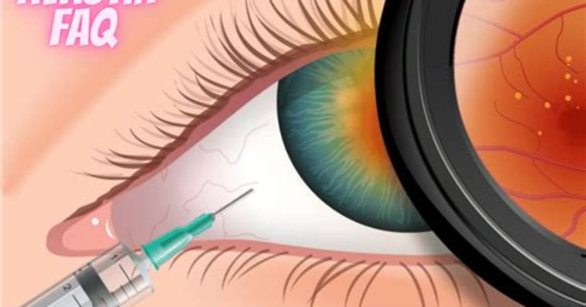 What Does Avastin Do for the Eye?
