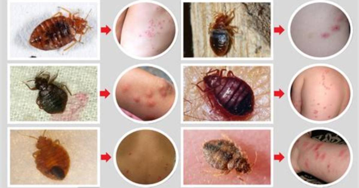 What Does Bed Bugs Bites Look Like?