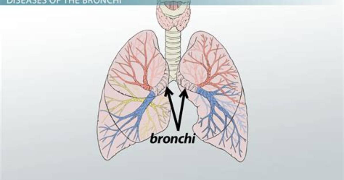 What Does Bronch O Mean