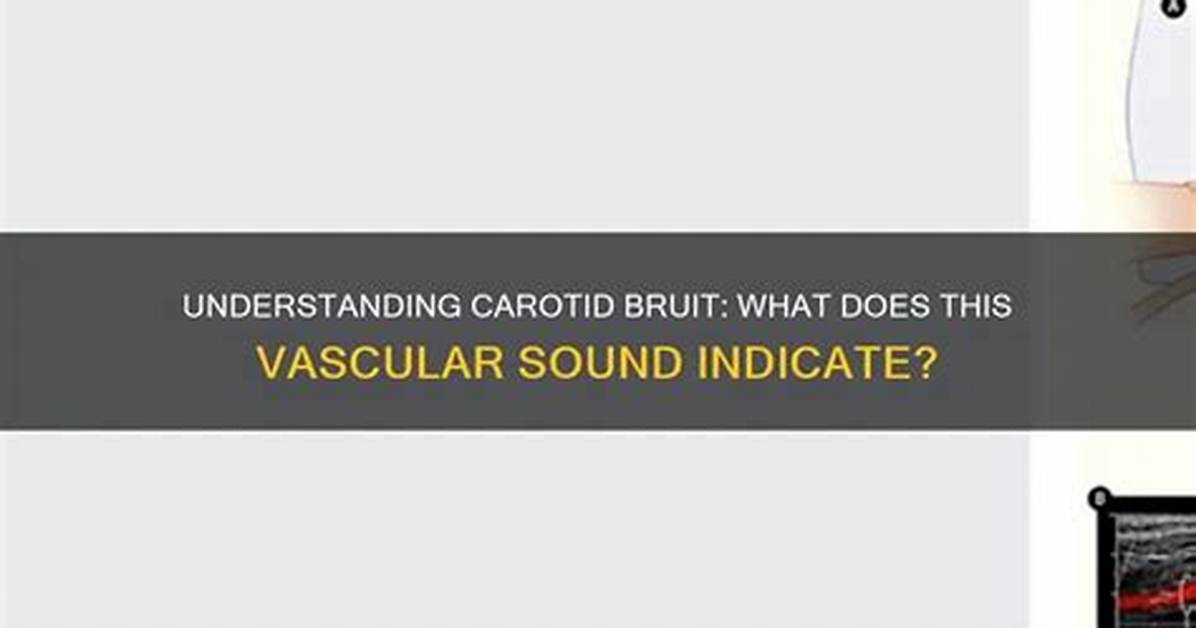 What Does Bruit Indicate?