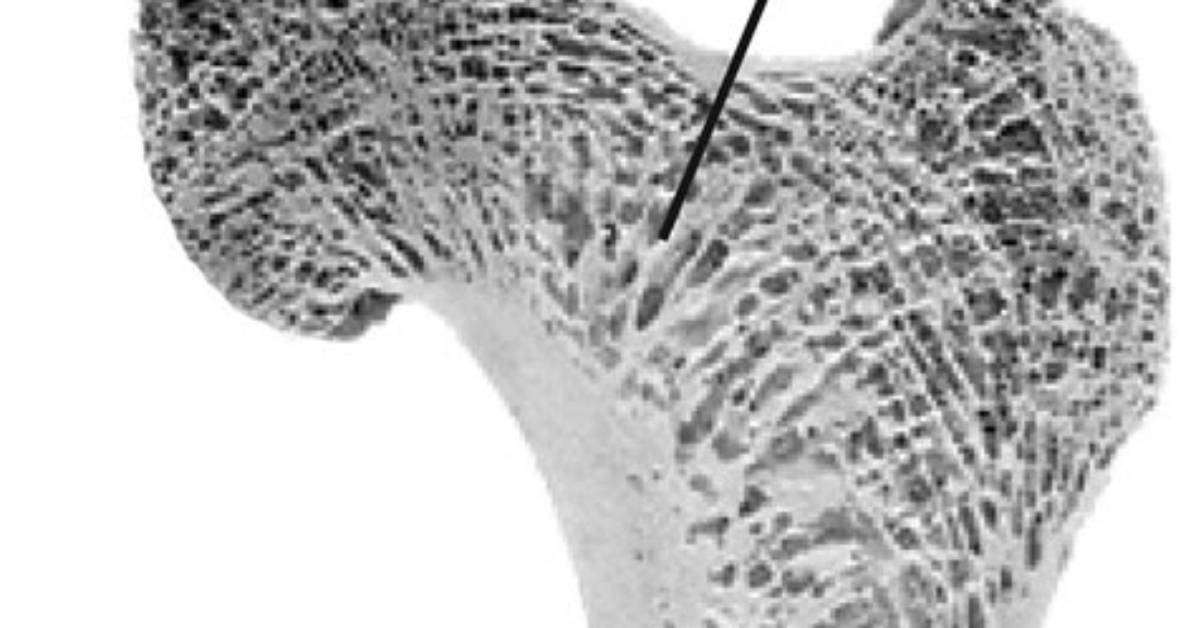 What Does Cancellous Bone Do?