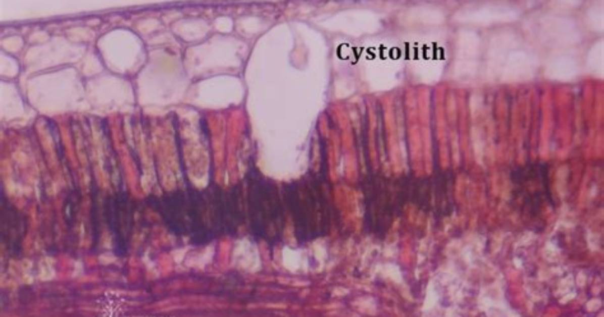 What Does Cystolith Mean?